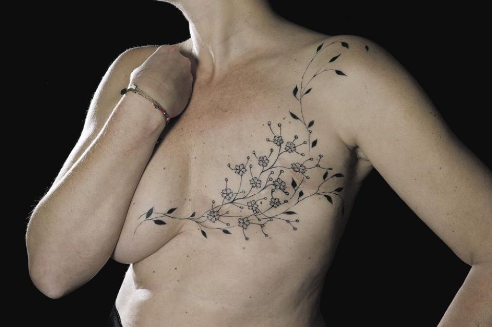 Chirurgie des seins : le tatouage 3D pour se reconstruire après un cancer