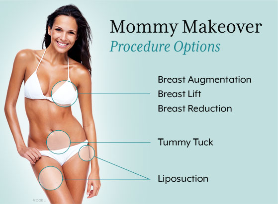 Mommy Makeover » : la tendance silhouette  d’après grossesse
